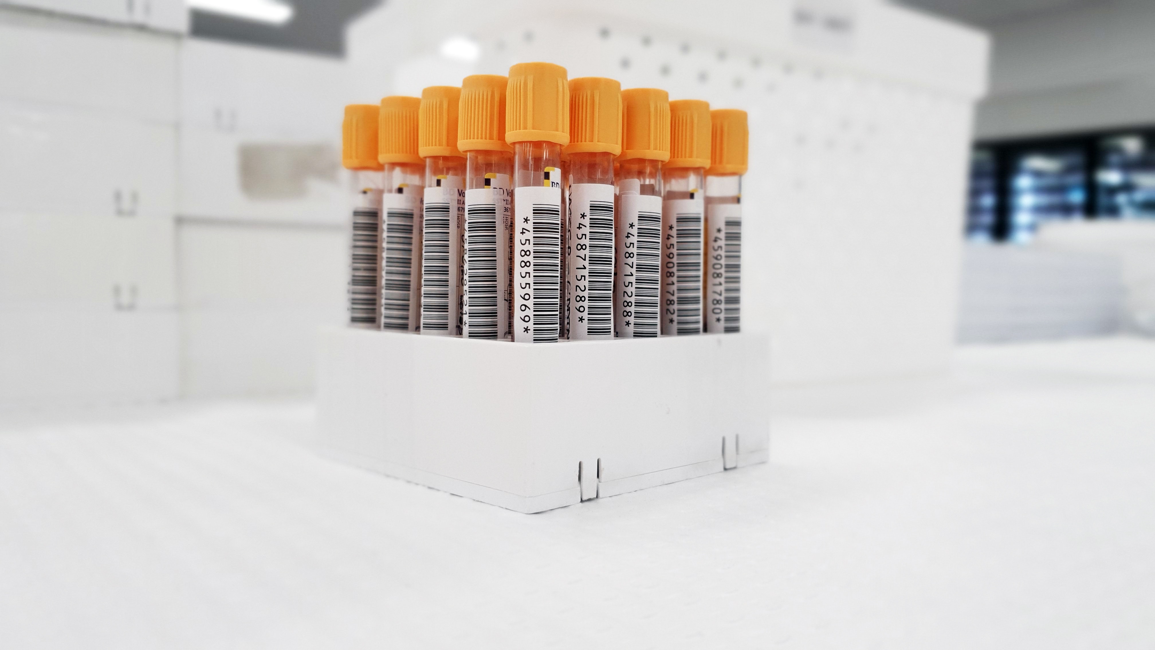 Yellow topped test tubes